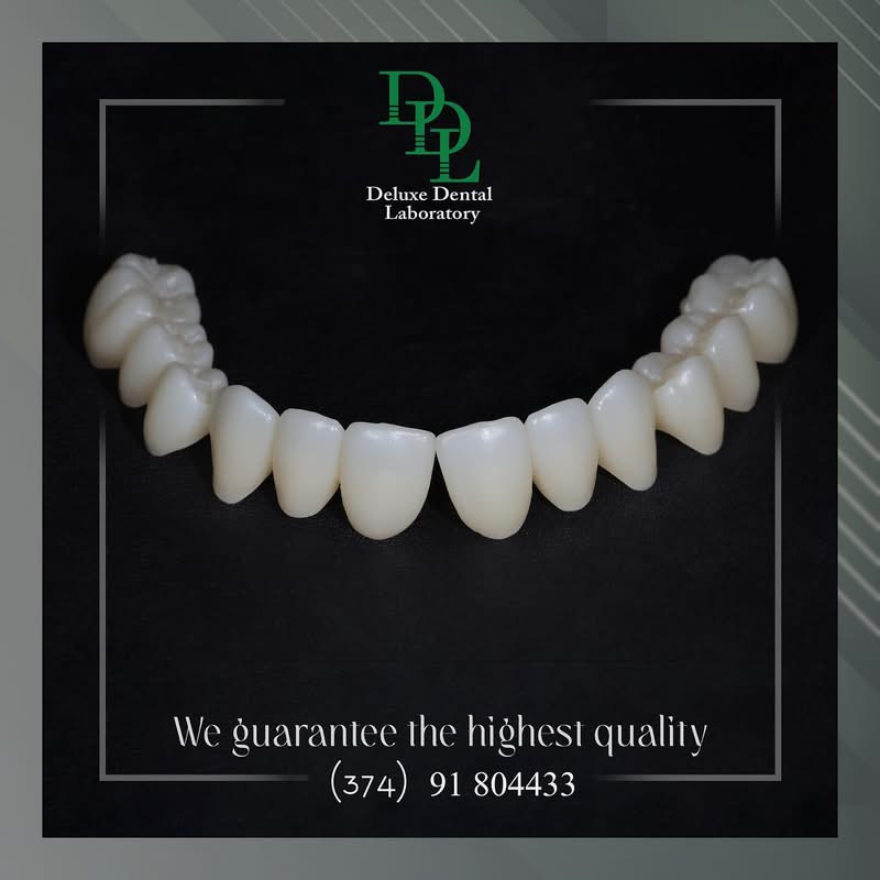 Full-contour zirconia crown restoration crafted at Deluxe Dental Laboratory — case 7