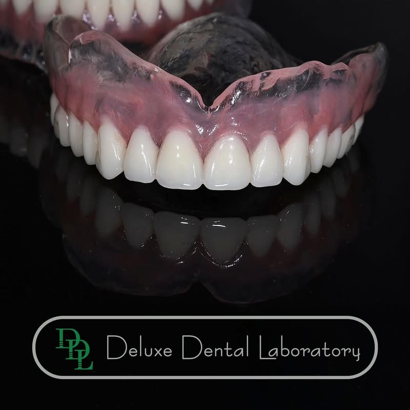 Hand-layered ceramic veneers showing natural shade gradient — case 9