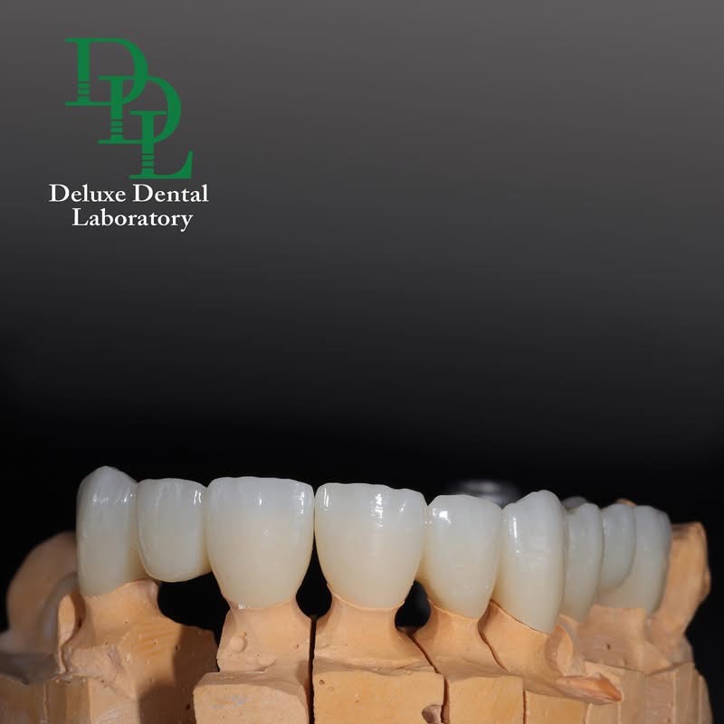 CAD/CAM digital design and precision-milled dental restoration — case 10