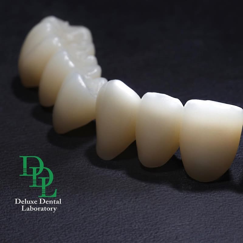 Full-contour zirconia crown restoration crafted at Deluxe Dental Laboratory — case 11