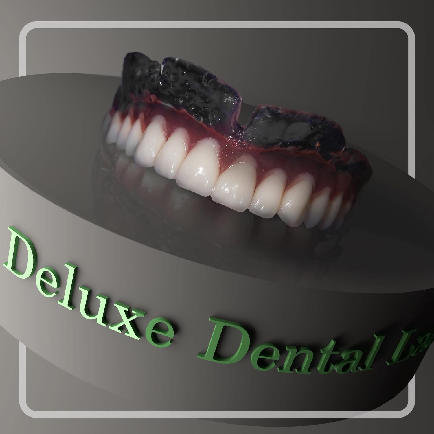 Hand-layered ceramic veneers showing natural shade gradient — case 14