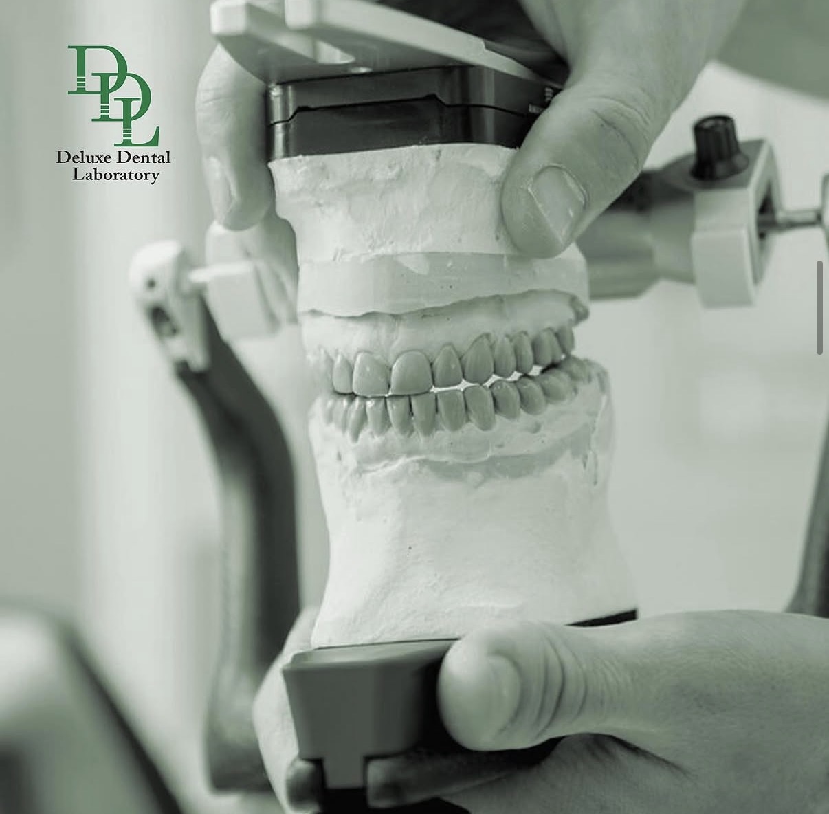 CAD/CAM digital design and precision-milled dental restoration — case 6